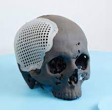impresion_3d_medida